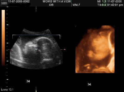The Ultrasound